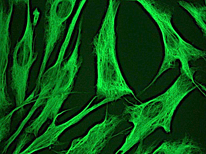 Figure 1. Indirect immunofluorescence staining of normal human dermal fibroblasts in tissue culture with MUB1903P (diluted 1:250), showing the specific cytoskeletal pattern of vimentin intermediate filaments.